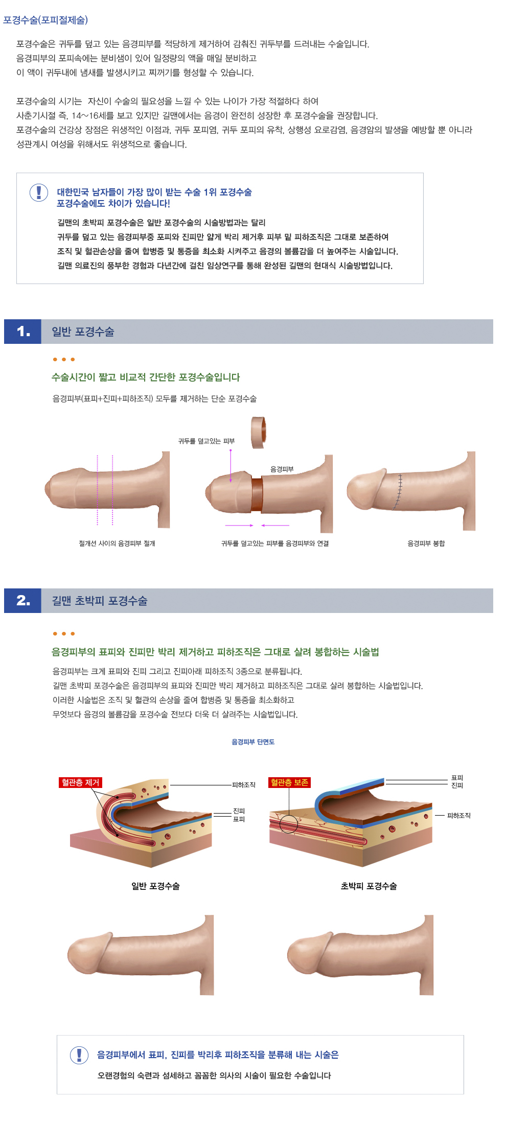 길맨 초박피 포경수술